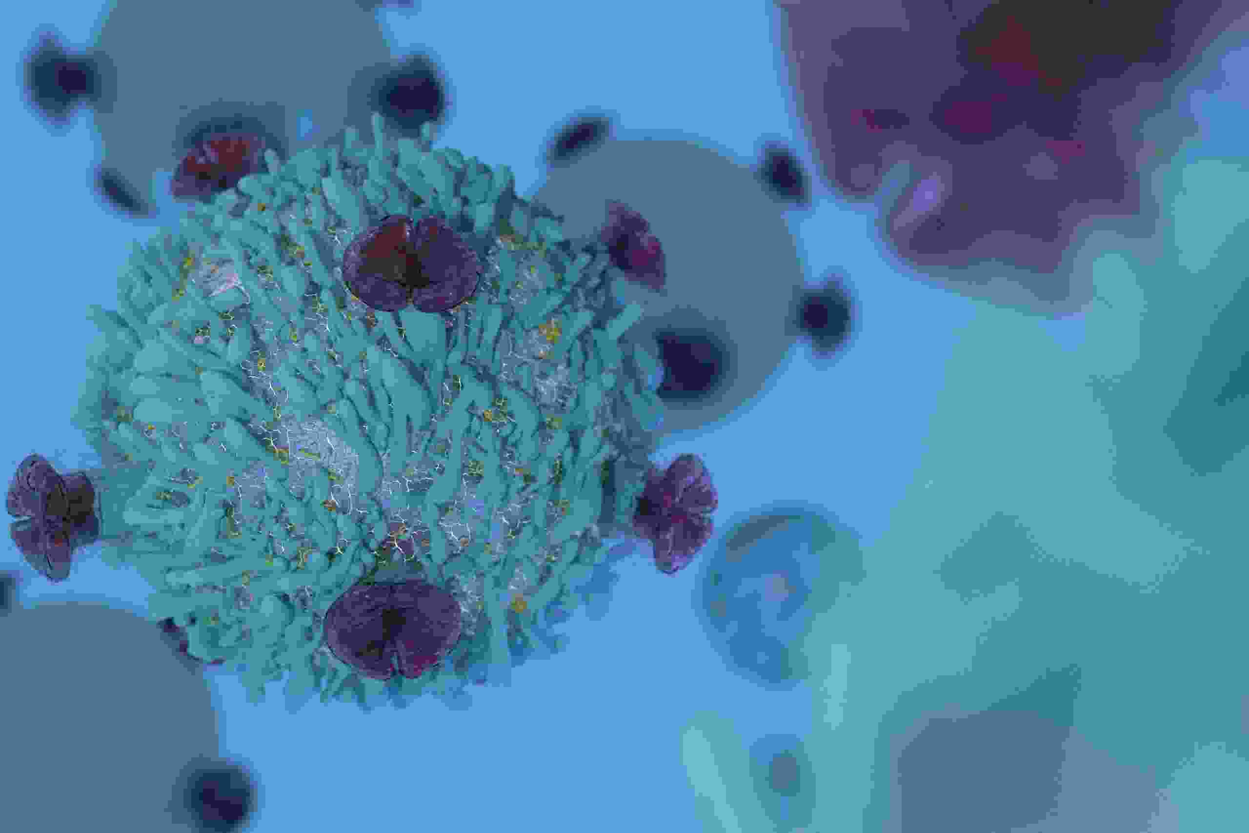 Cell Lymphoma